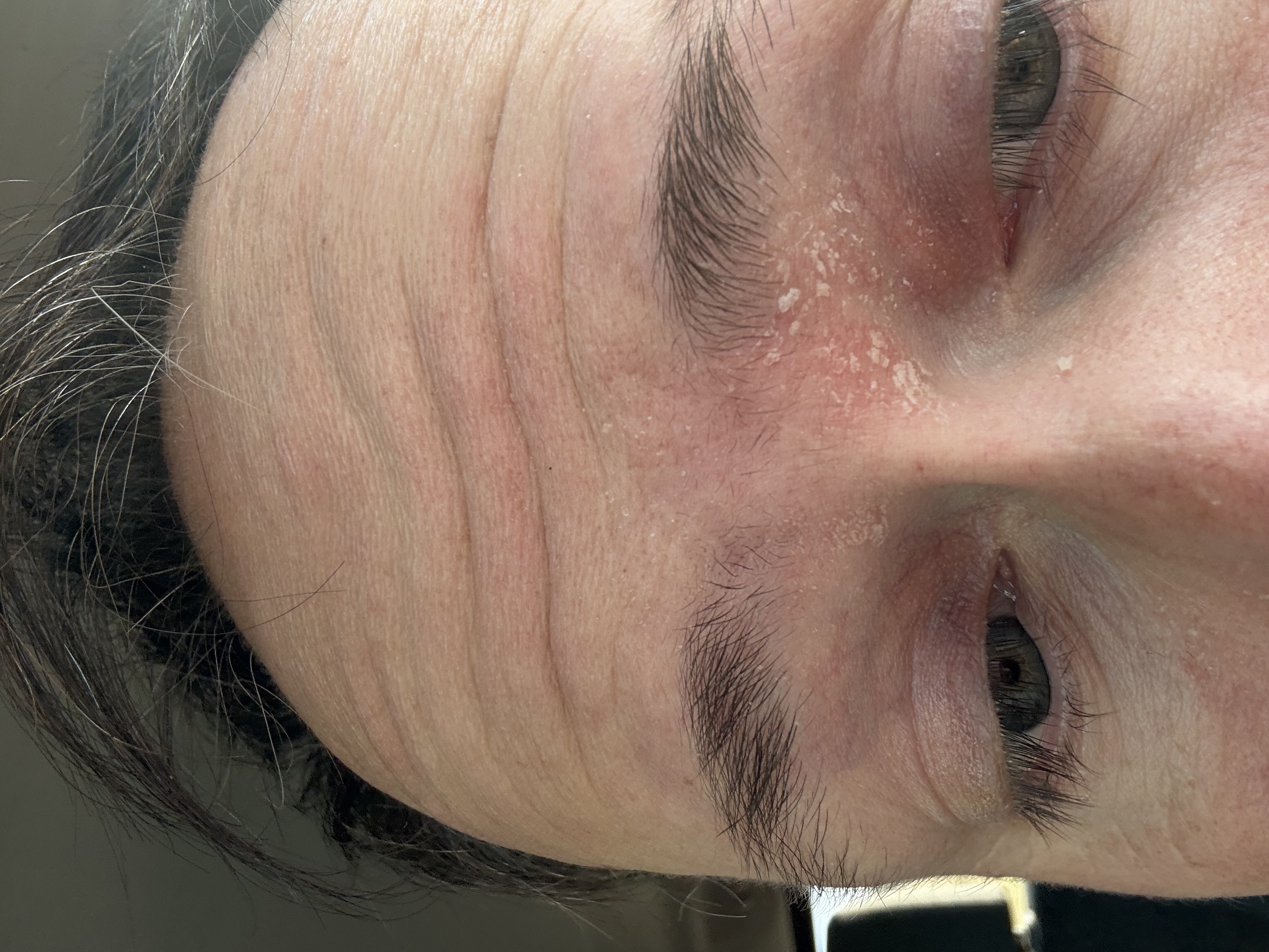 Before using Glow Oil