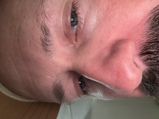 After using Glow Oil